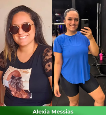 Alexia-Messias-Antes-e-depois-1-768x864-1.webp