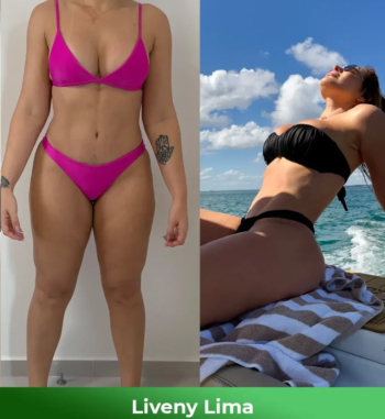 Liveny-Lima-Antes-e-depois-1-768x864-1.webp