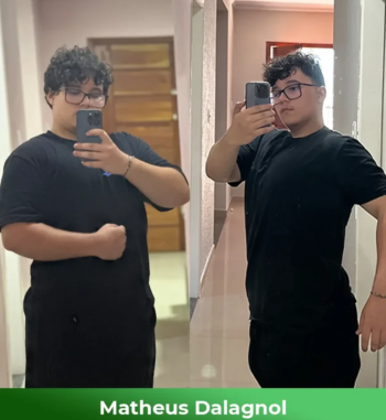 Matheus-Dalagnol-Antes-e-depois-1-768x864-1.webp